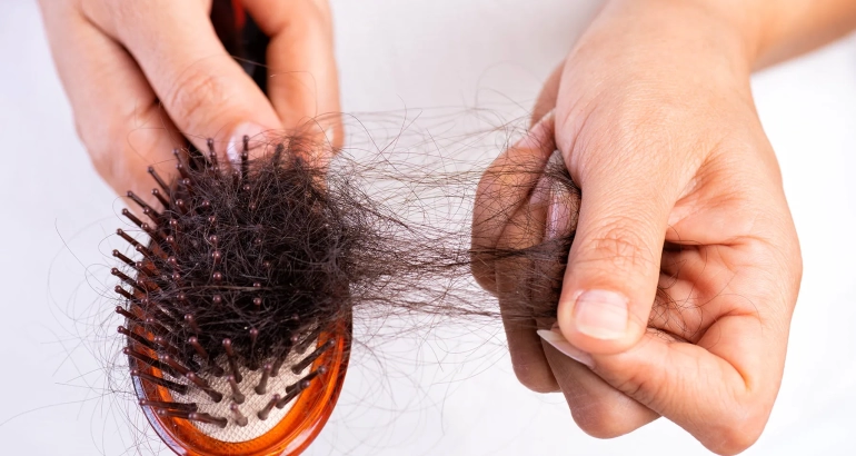 Unlock the Secrets to Treat Hair Loss and Revitalize Your Hair Growth Journey