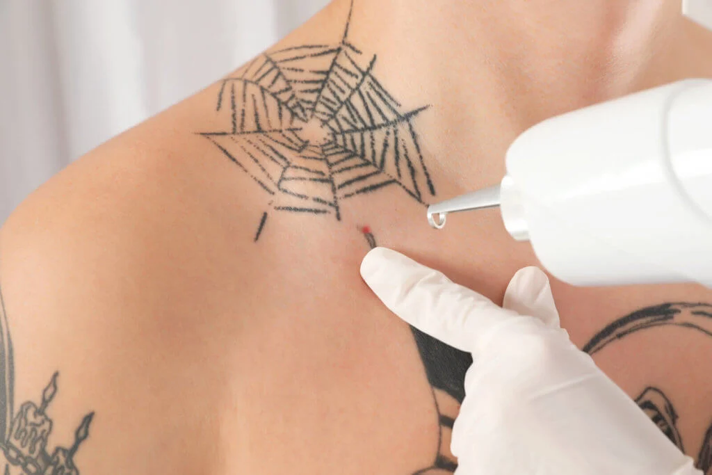 Unraveling the Essentiality of Proper Aftercare in Tattoo Removal: A Skin Health Perspective