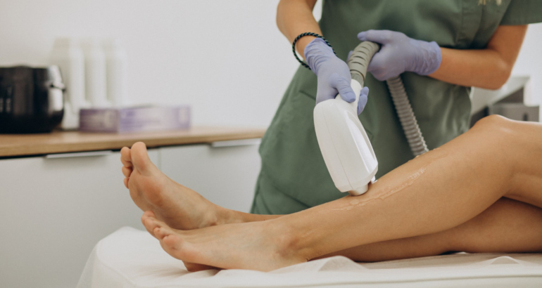 Unlock Smooth Skin: The Ultimate Guide to Laser Hair Removal